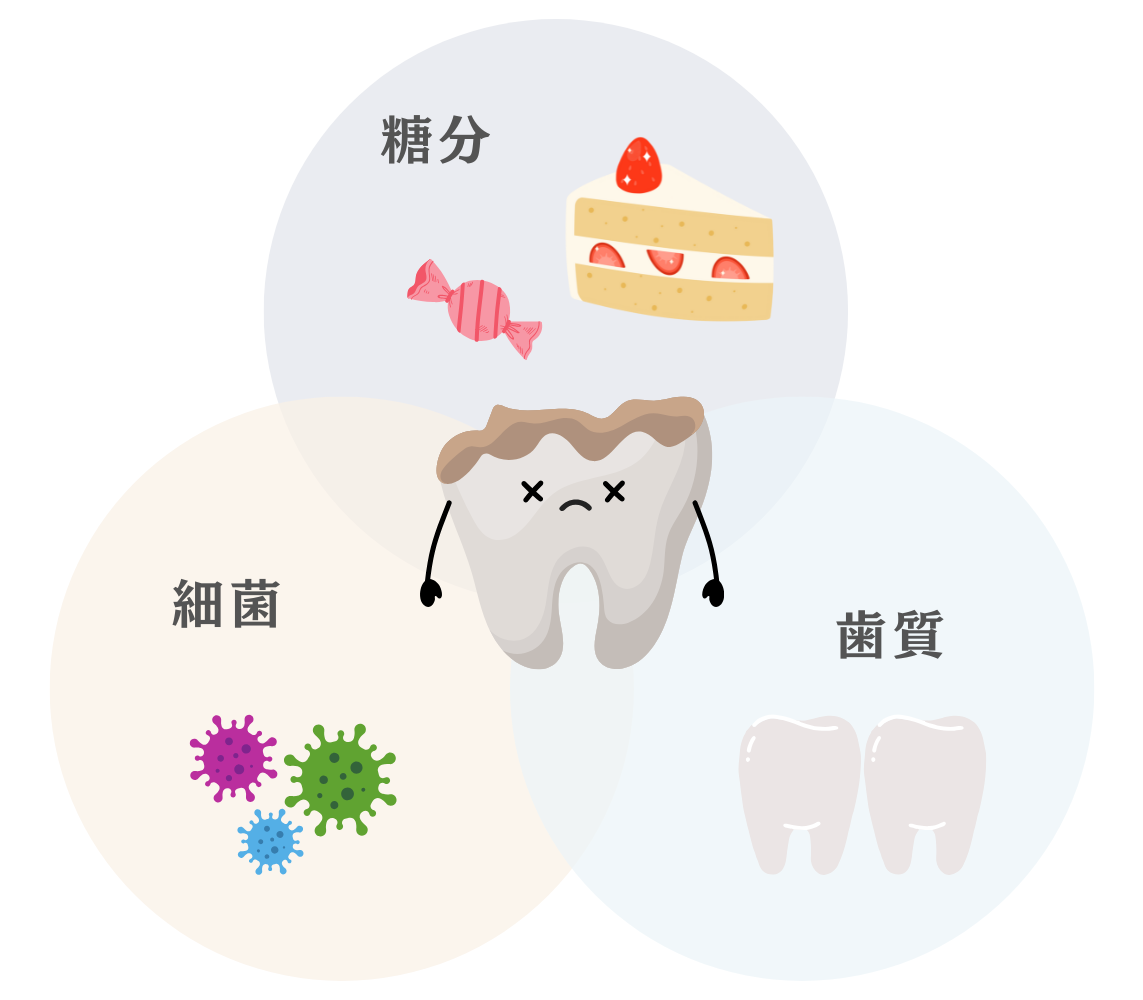 虫歯の原因